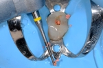 Il Dr. Polesel utilizza molto spesso la Fresa EndoTracer di Komet, e lo definisce lo strumento indispensabile per l’endo-restaurativa minimamente invasiva. Precisione e sicurezza per risultati eccellenti.