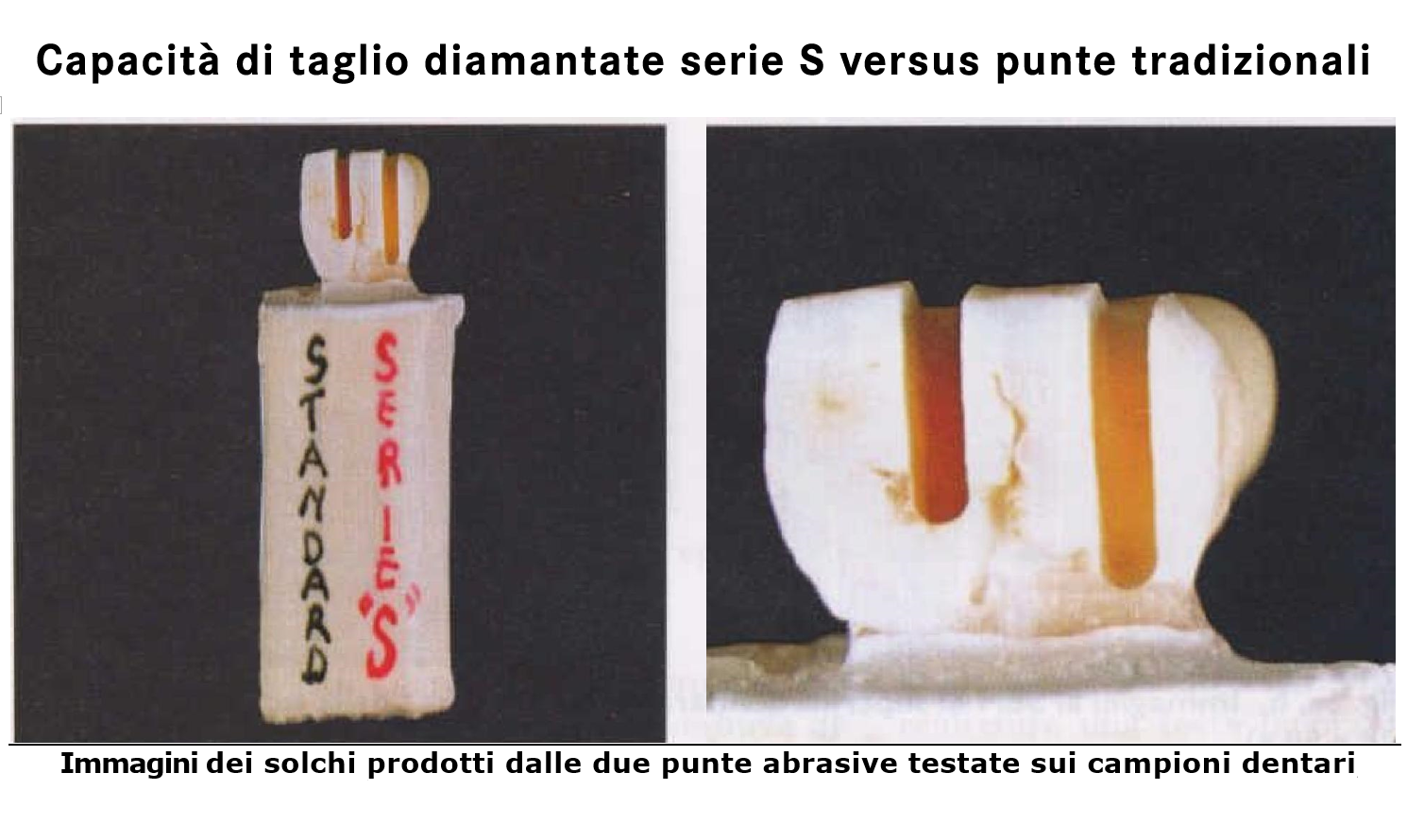Le punte diamantate Komet serie S per la preparazione protesica sono state sviluppate per evitare vibrazioni e ottenere il 19% in più di capacità di taglio.