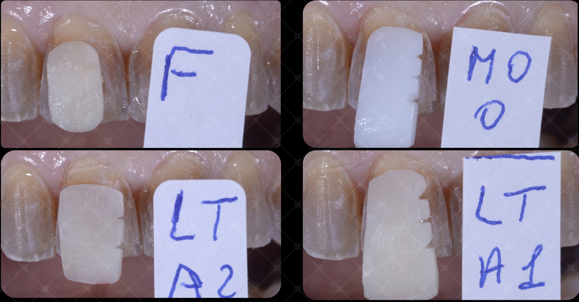 Fig20 caso macca