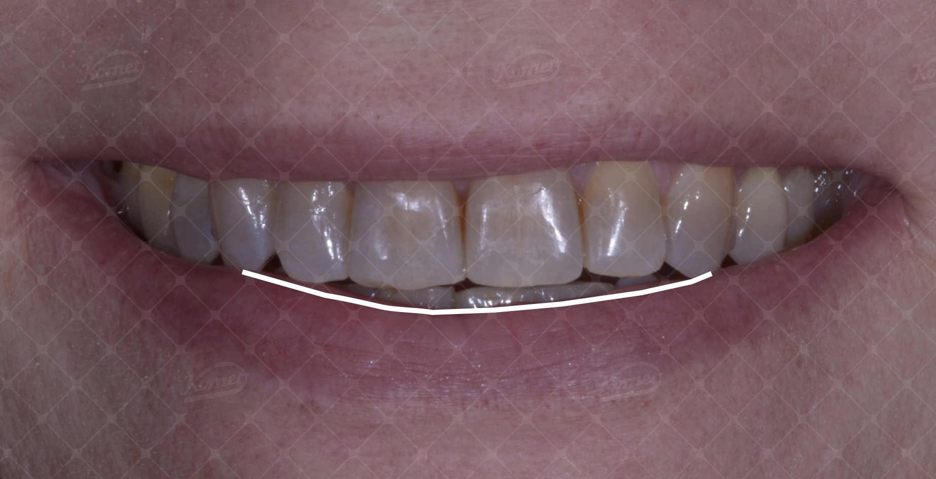 Fig4 caso macca