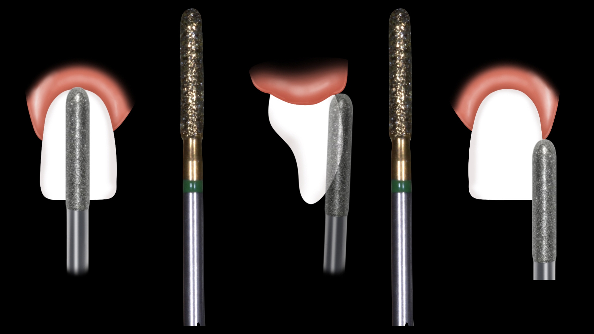 Fig8 caso macca