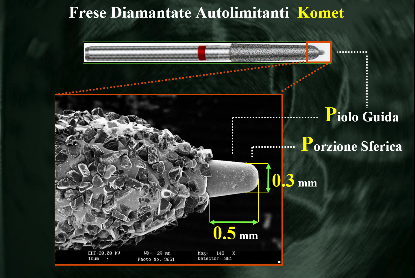 profondità definita di preparazione e minime irregolarità del margine, rendono le frese con piolino guida particolarmente indicate nella pratica clinica.