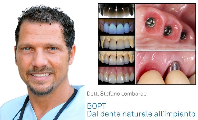Il Dr. Stefano Lombardo mostra il protocollo B.O.P.T. (Biologically Oriented Preparation Technique) attraverso un caso clinico e la gestione dei provvisori.