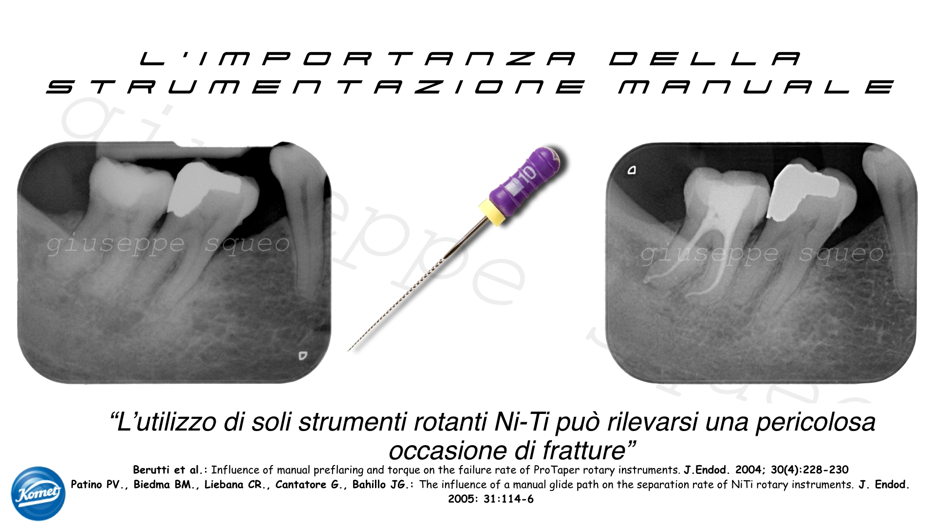 Strumenti manuali per endodonzia