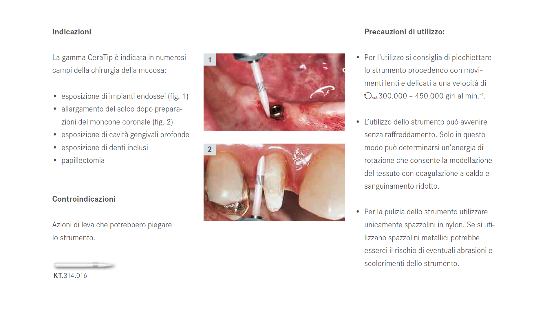 CeraTip è indicato per la chirurgia della mucosa: esposizione di impianti endossei e allargamento del solco dopo preparazione del moncone coronale.