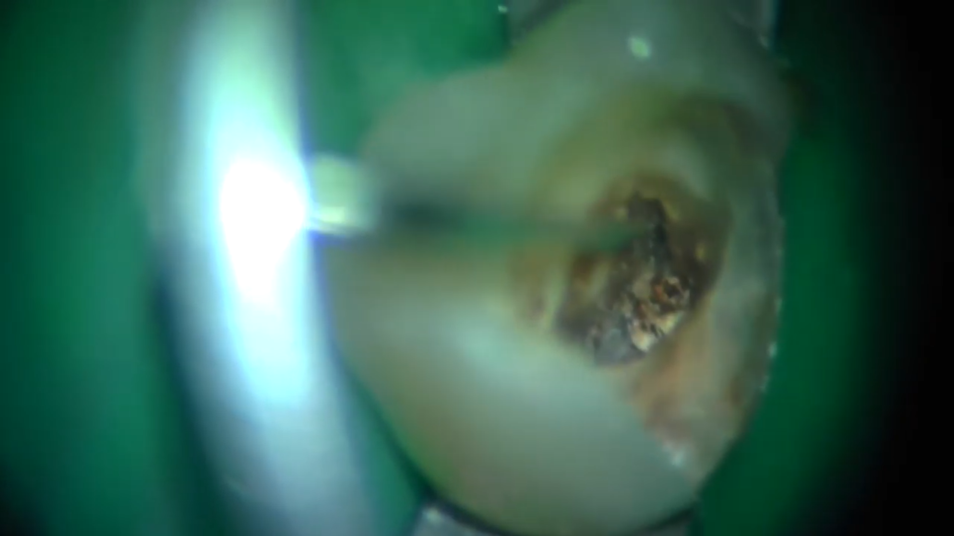 Case report Dr Fava ritrattamento 44 (5)