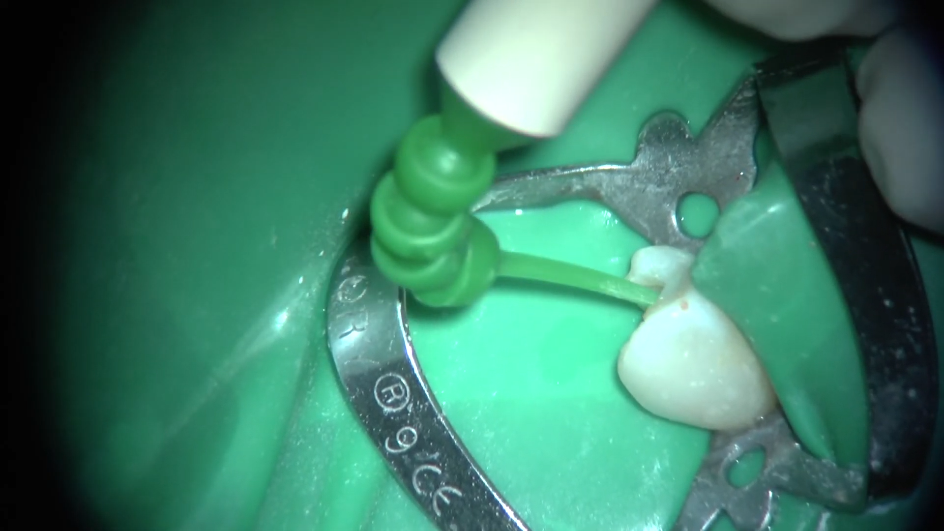 Case report Dr Fava ritrattamento 44 (7)