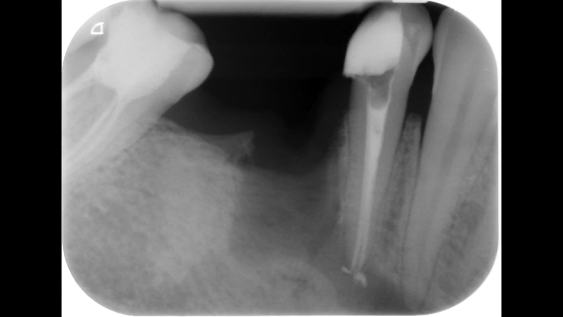 Case report Dr Fava ritrattamento 44 (8)