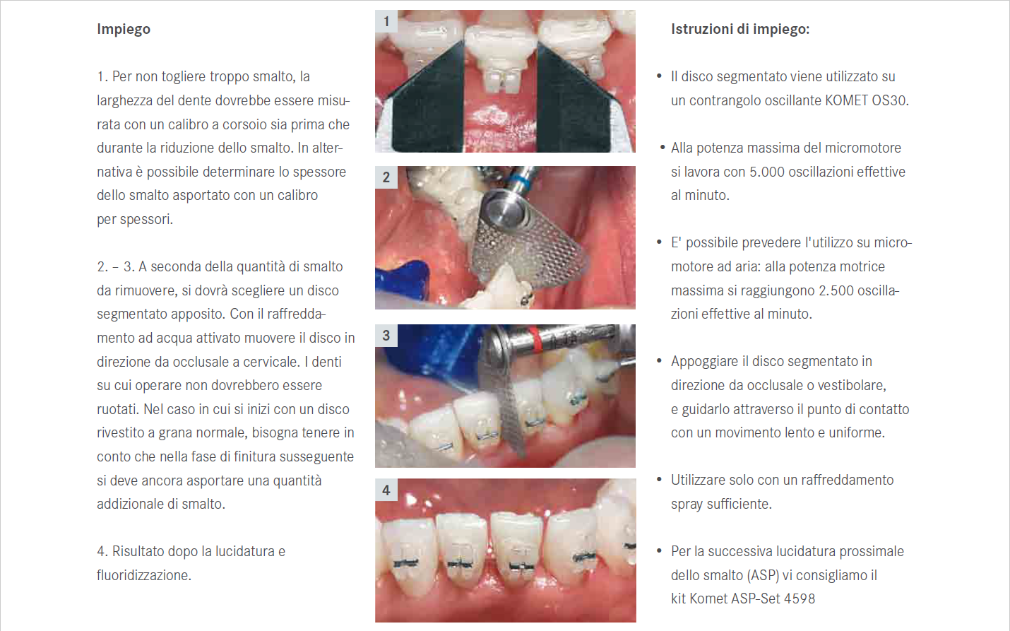 Il Dr. Filomia ha ideato il kit 3706 con i dischi segmentati OS per stripping, che offrono una visuale ottimale e un'efficacia superiore