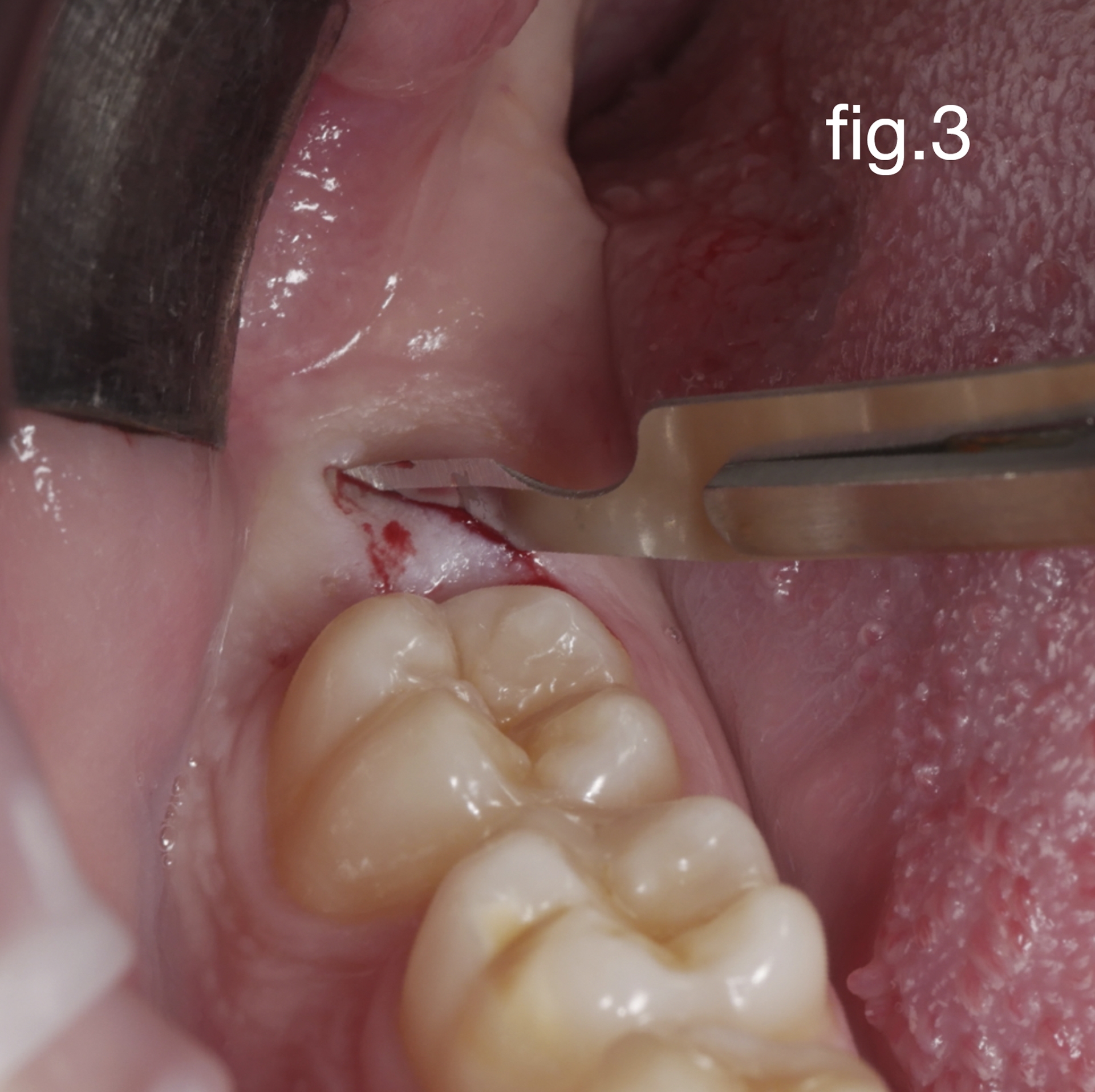 Caso Dr Baleani fig3