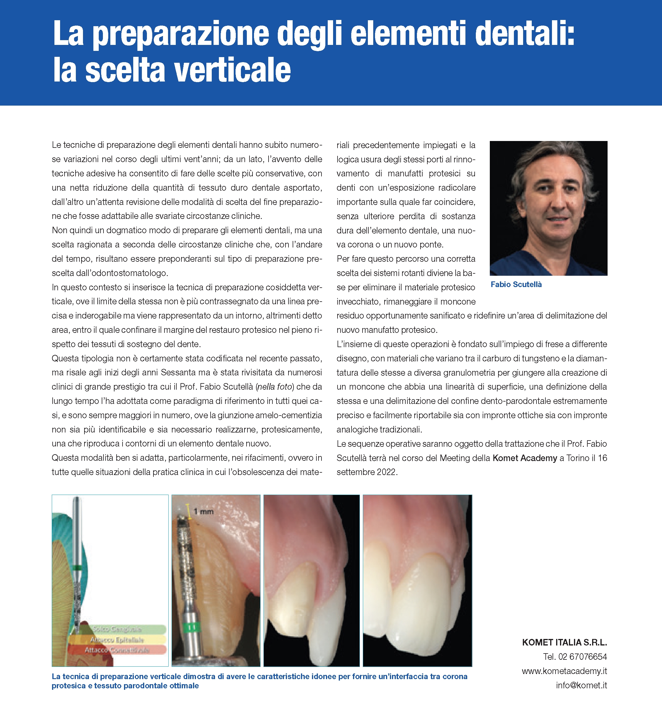 Video della relazione che il Dr. Scutellà ha illustrato al Congresso Nazionale 2021 Errori da evitare nelle preparazioni protesiche verticali