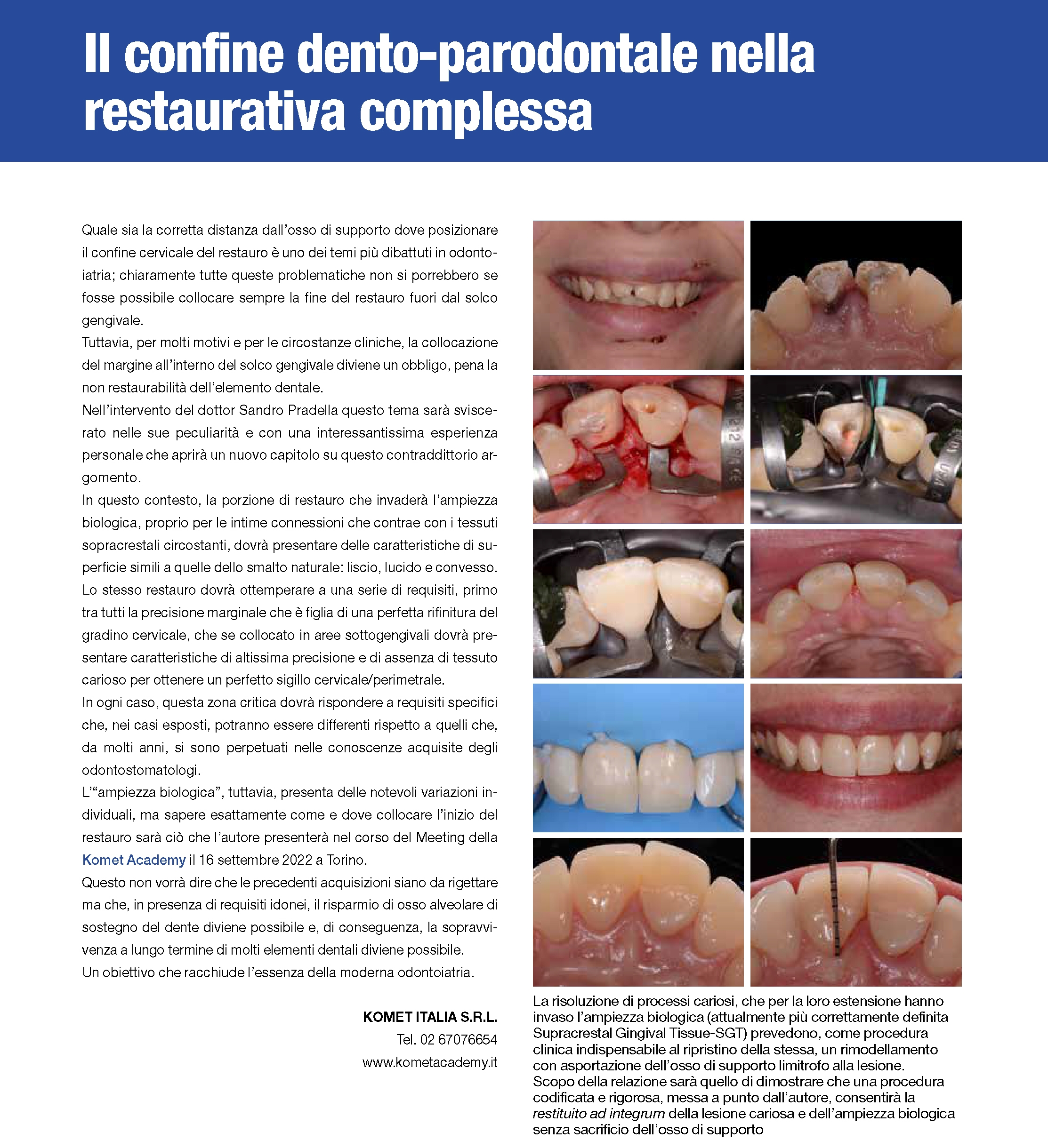 Tecniche adesive in restaurativa - video del Dr. Sandro Pradella al Convegno di Verona del 21 ottobre 2023 della Komet Academy