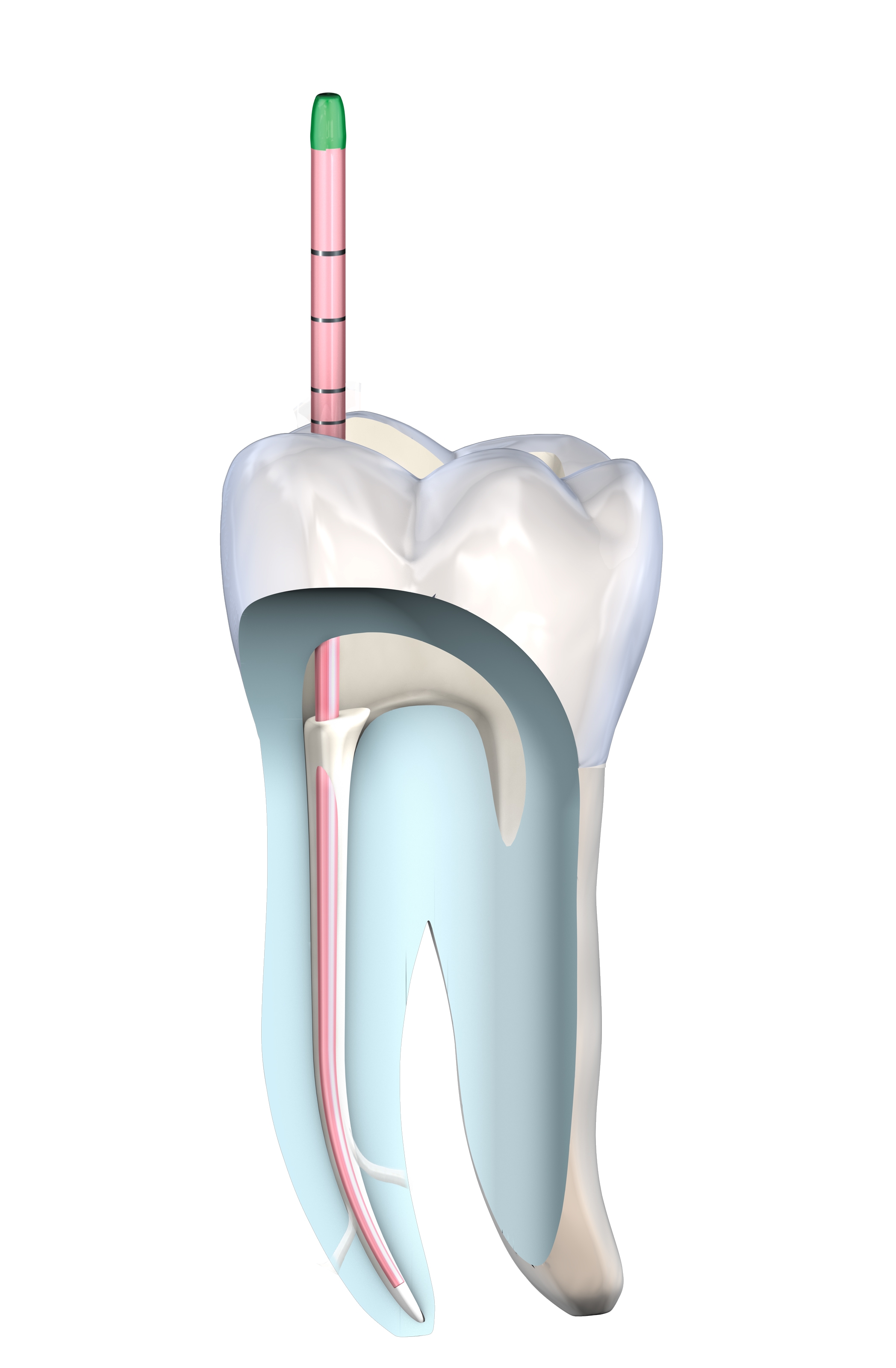 KometBioSeal_Step2