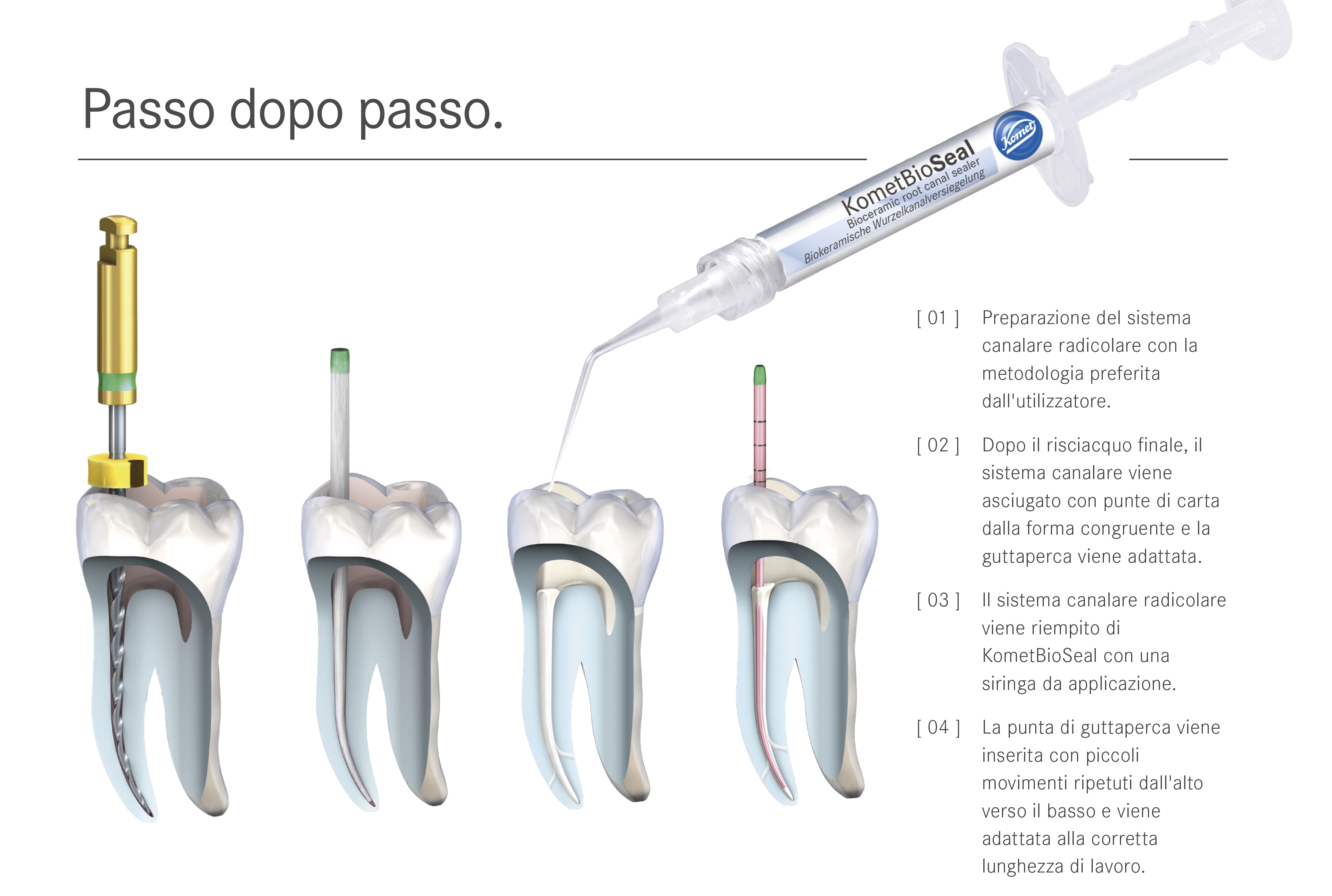 Il legame adesivo e la stabilita dimensionale del bioceramico BioSeal prevengono nuove infezioni indesiderate del canale radicolare