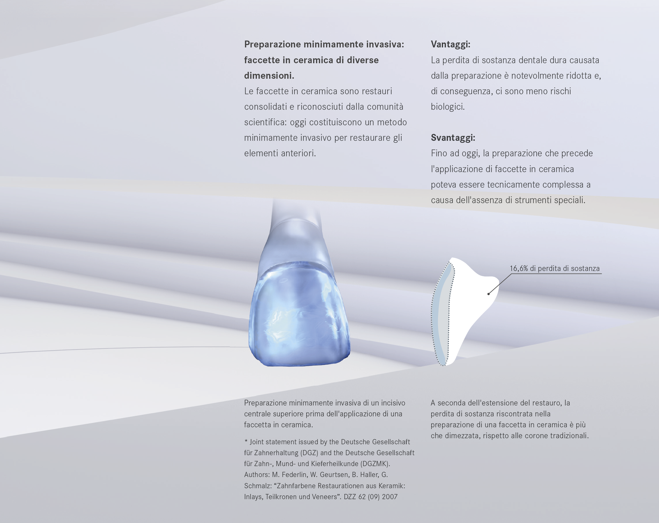 Perfect Veneer Preparations