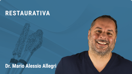 Corso teorico-pratico di aggiornamento in odontoiatria restaurativa: lo stato dell’arte delle Tecniche Dirette e Indirette
