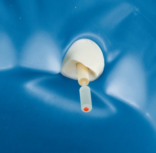 Innovazione nei perni in fibra di vetro