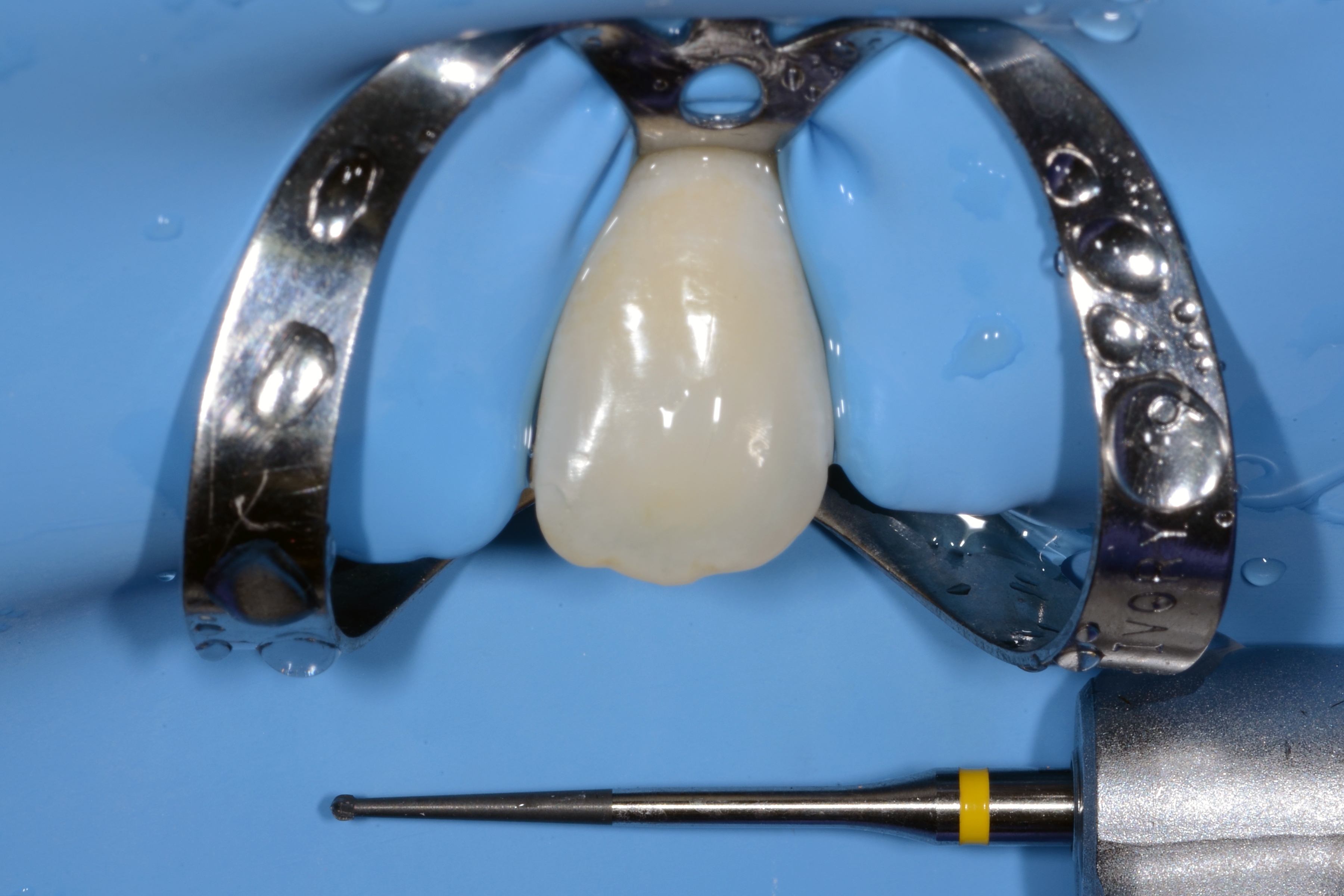 La scoperta di EndoTracer La scoperta di EndoTracer