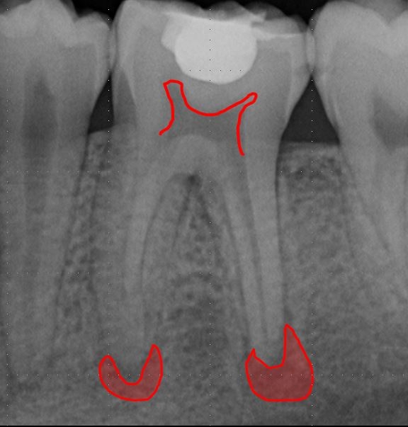 Case report