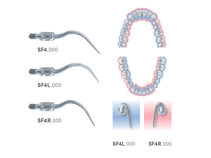 Scaler parodontale