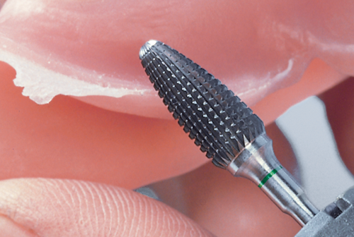 Dentatura FSQ