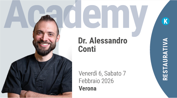 Faccette senza segreti 