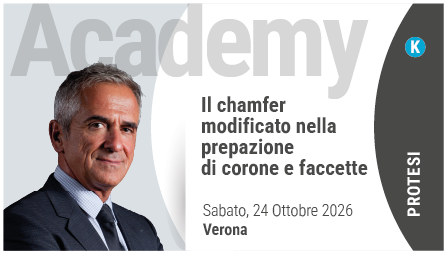 Il chamfer modificato nella prepazione di corone e faccette
