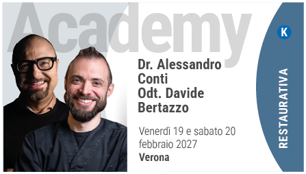Faccette senza segreti
