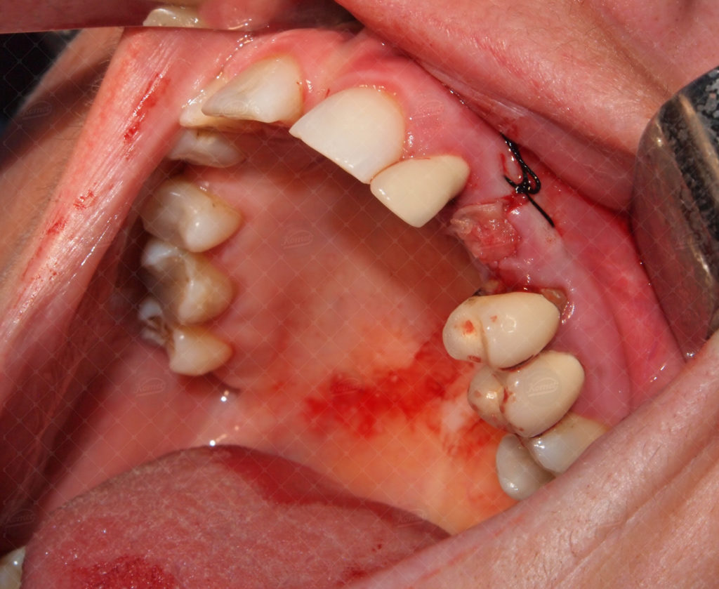 Case report Dr E Ruga (25)