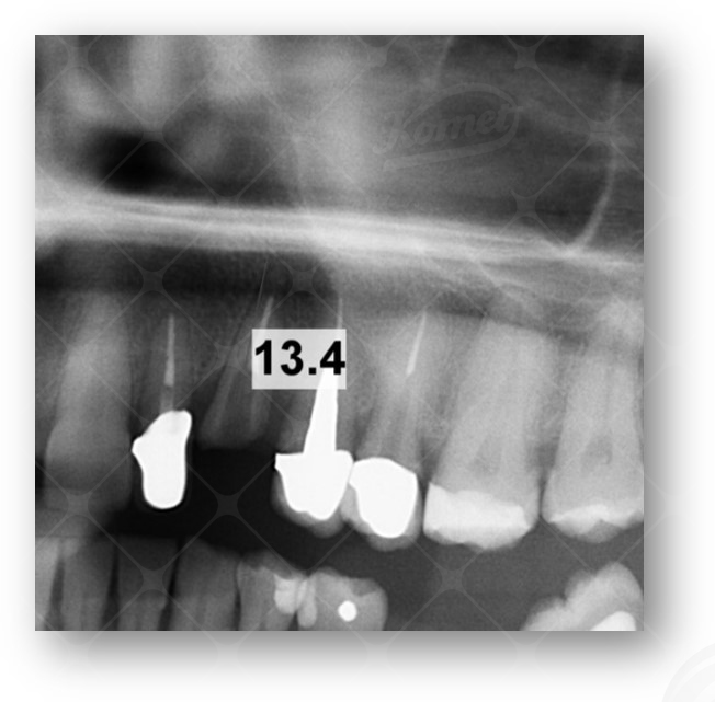 Case report Dr E Ruga (3)