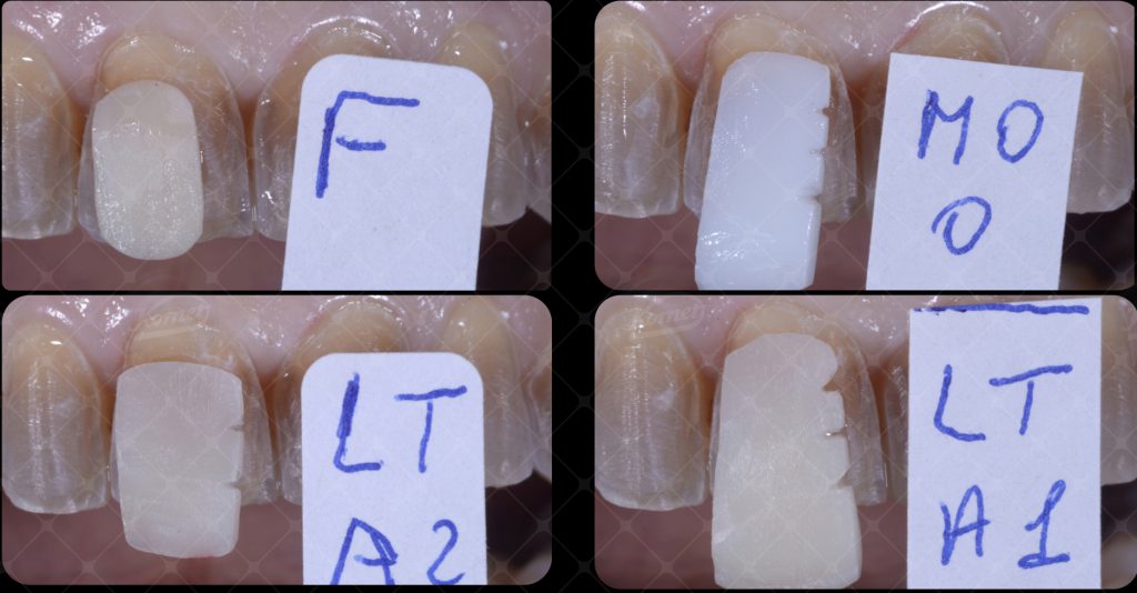 Fig20 caso macca