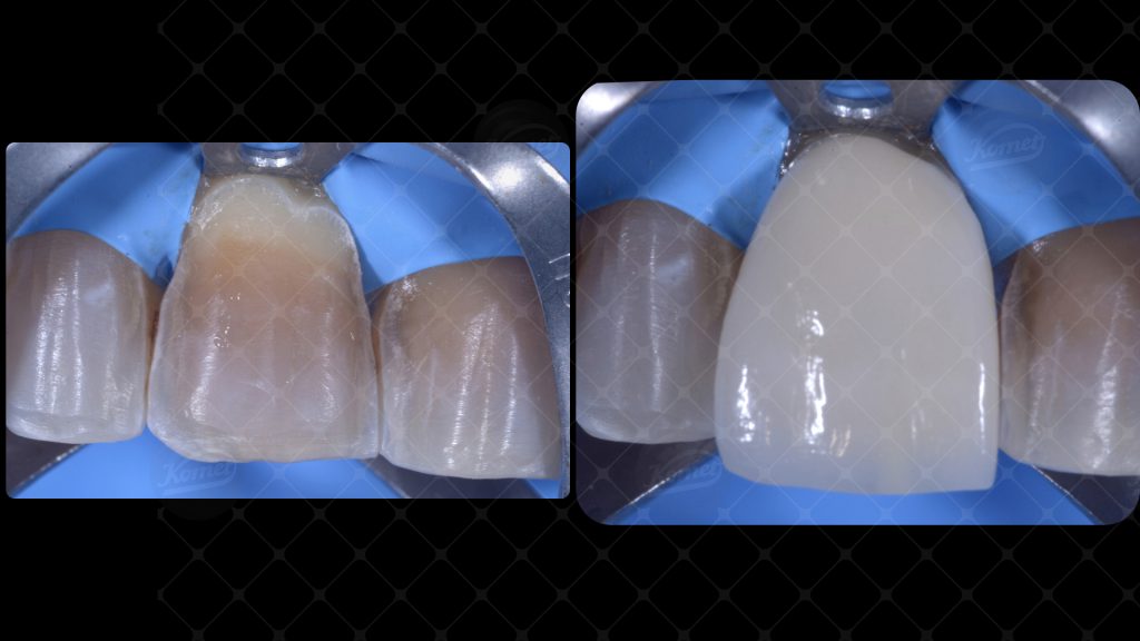 Fig24 caso macca