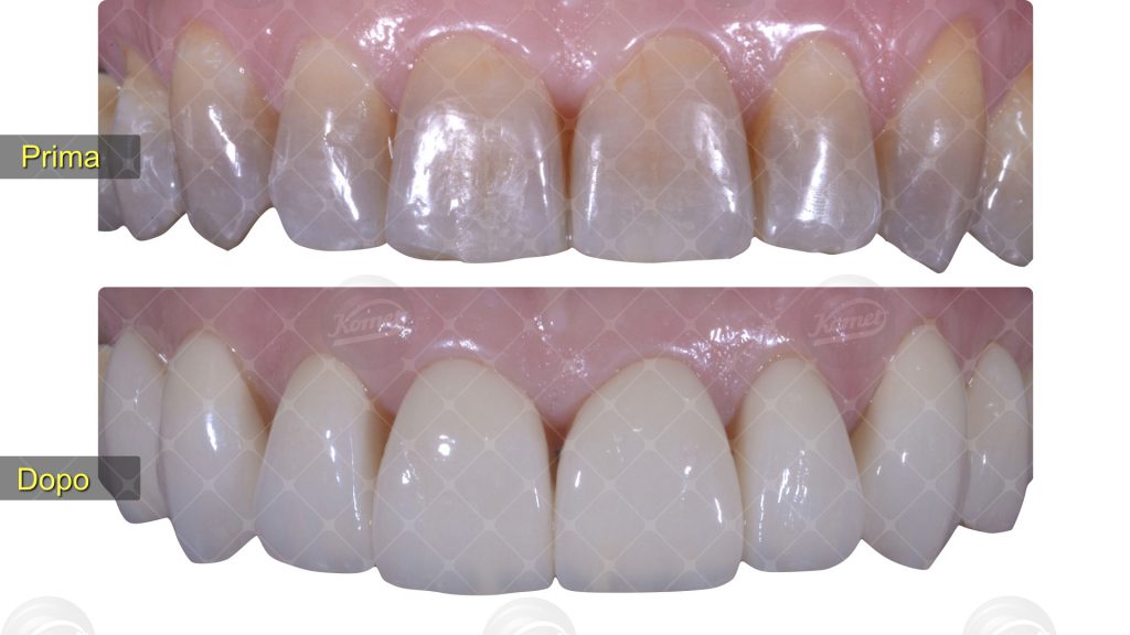 Fig27 caso macca
