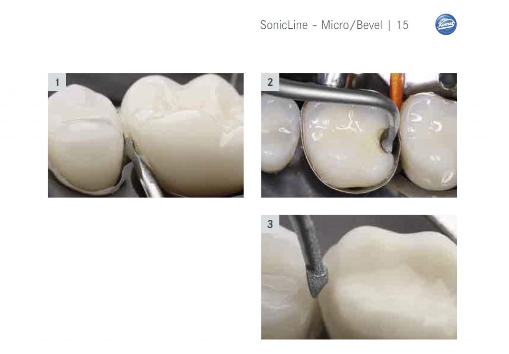 MicroBevel punte soniche