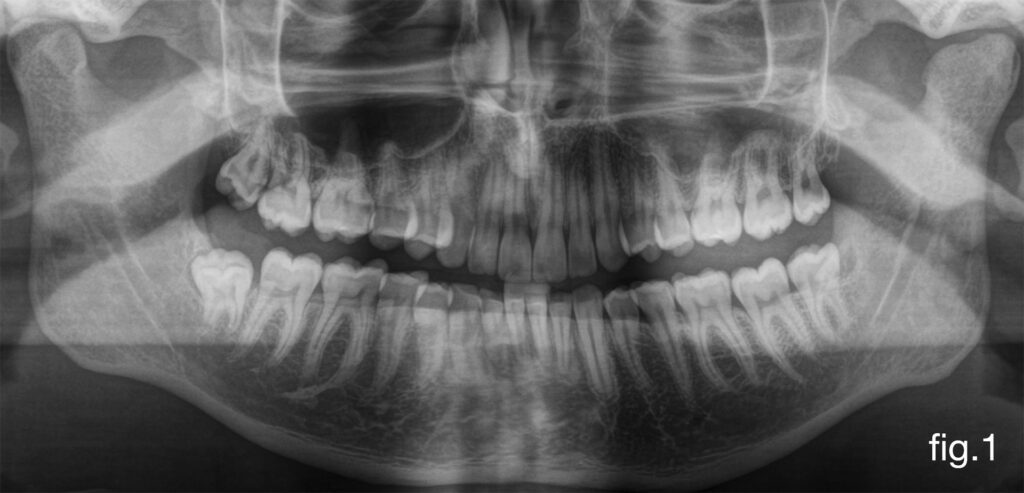 Caso Dr Baleani fig1
