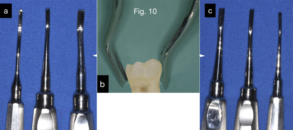 Caso clinico Dr. Baleani fig10