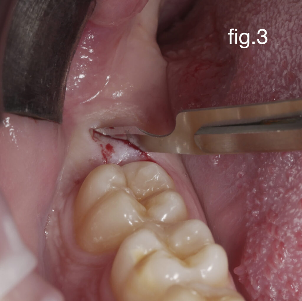 Caso Dr Baleani fig3