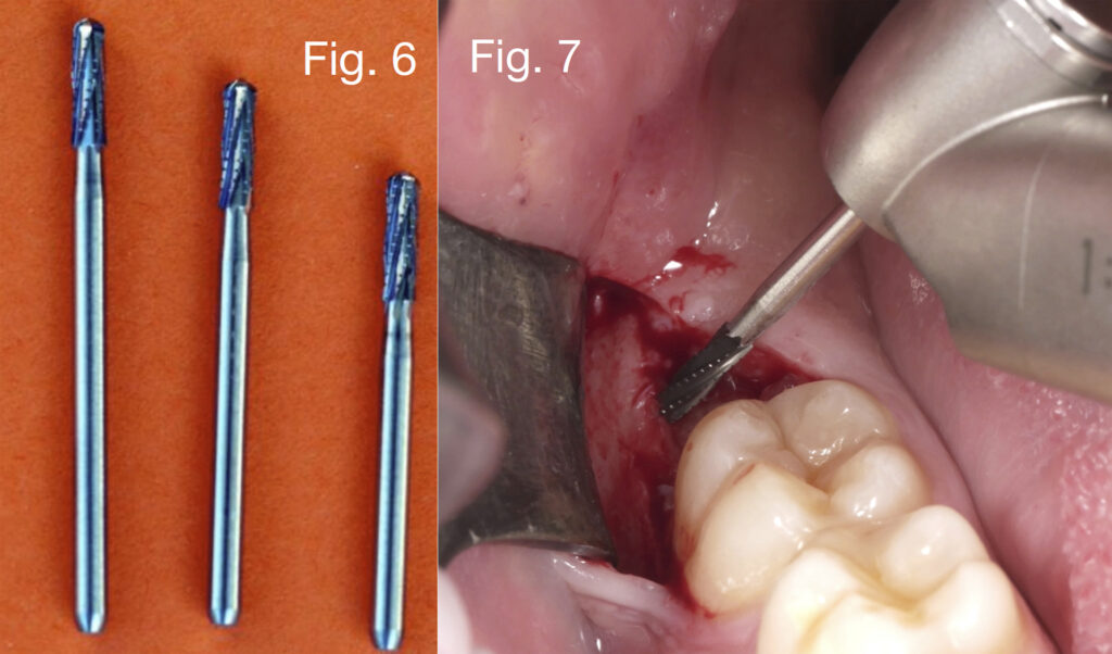 Caso clinico Dr. Baleani fig6 e 7