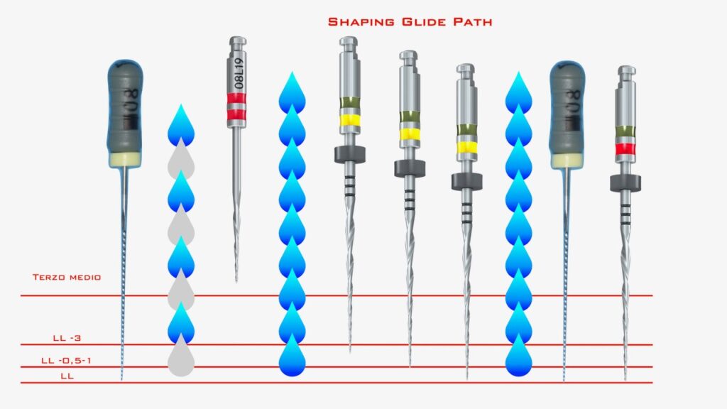 Shaping Glide Path by Dr Fava
