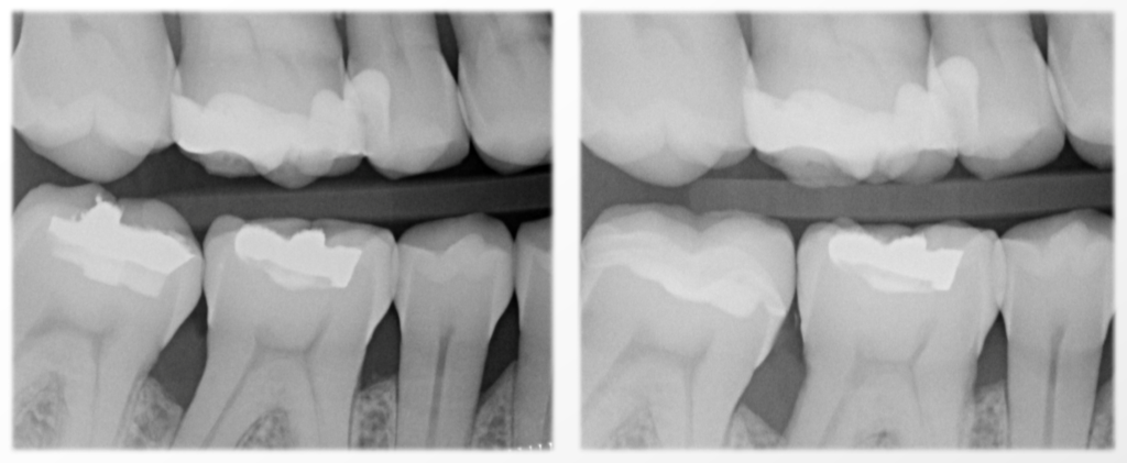 Controllo radiografico