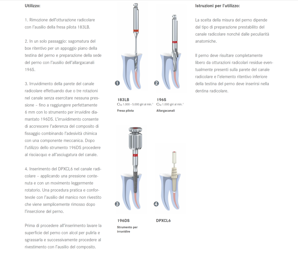 PERNI Dentin Post X Coated procedura